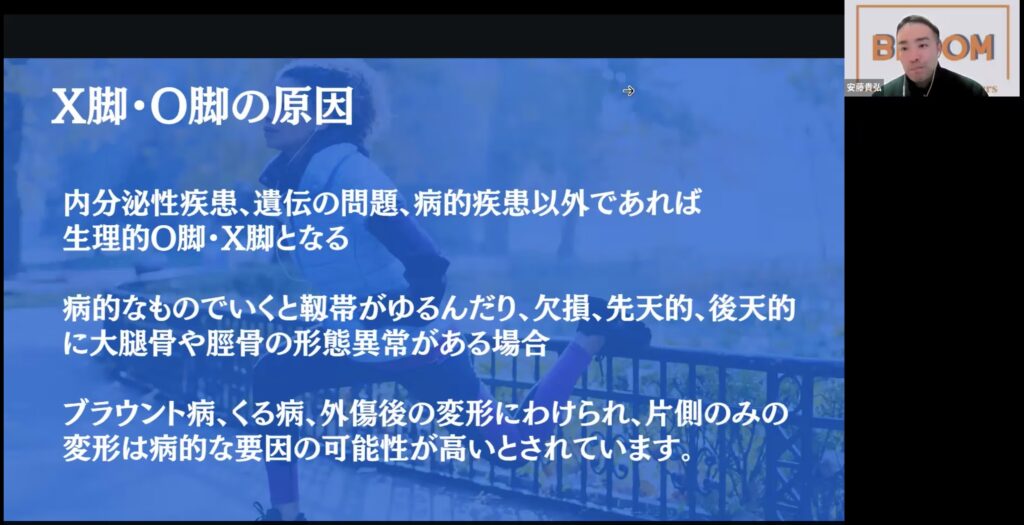 それ本当に合ってる！？X脚O脚に対するアプローチ方法の本質とは！？